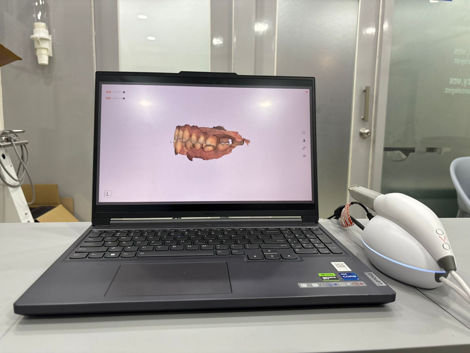 3D intraoral scanning station